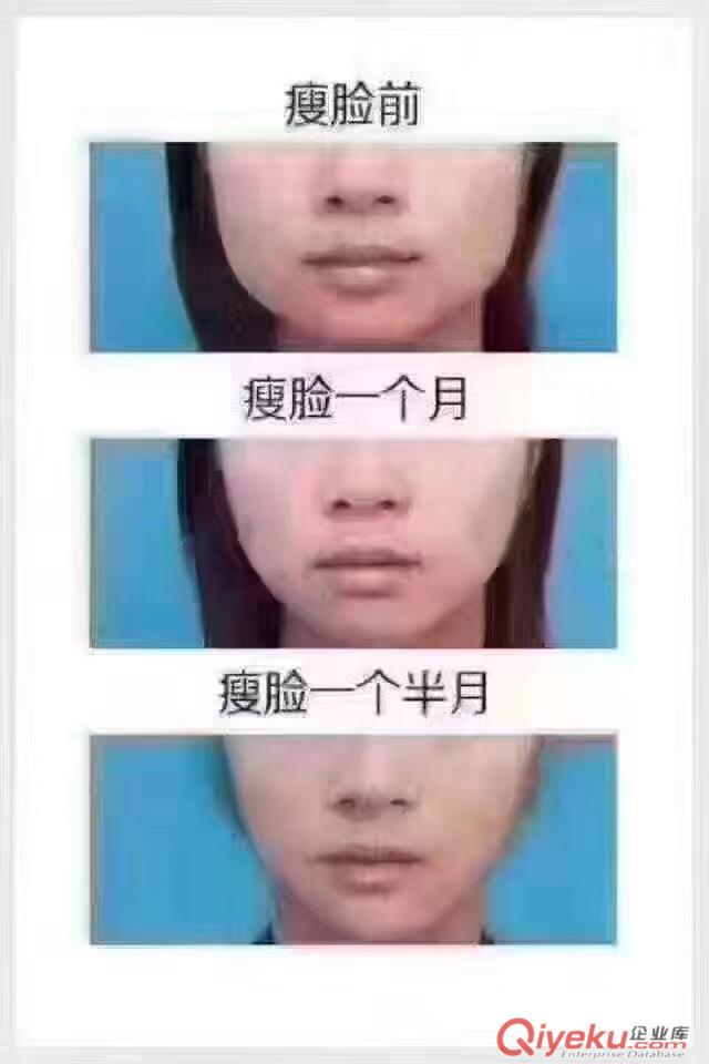 【德州韓繡整形】德州哪里可以打瘦臉針？國(guó)產(chǎn)瘦臉針和進(jìn)口瘦臉針有什么區(qū)別？原始圖片2