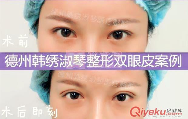 【德州專業(yè)整形醫(yī)院】自體脂肪移植——把“垃圾”變成“財富”