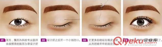 德州做埋線雙眼皮多少錢？什么眼睛條件適合做埋線雙眼皮？