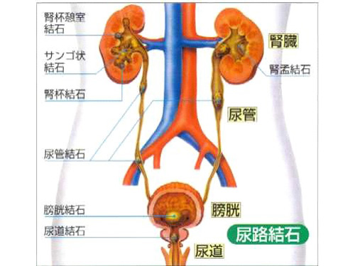 體外碎石上曙光-廈門(mén)zl結(jié)石哪家醫(yī)院比較好