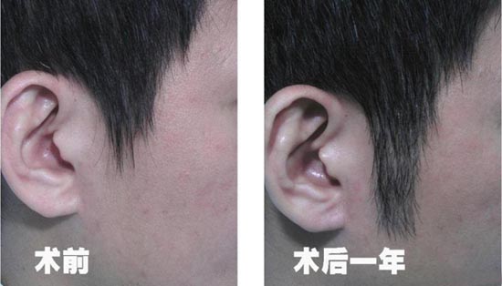 廣州毛發移植培訓