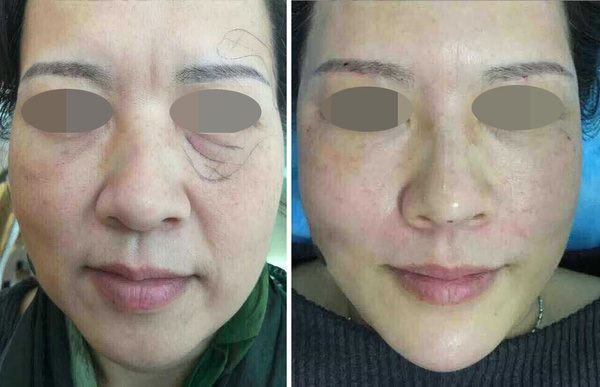 广州线雕培训