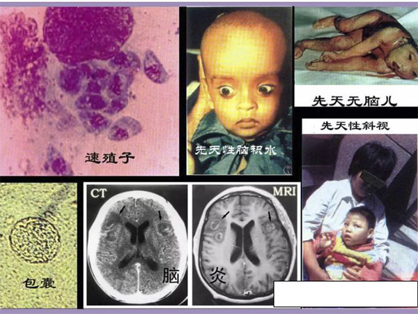 健康有理健康檢測基站_弓形蟲檢測設備_健康有lq血檢測儀_健康有理千年古方熏蒸？