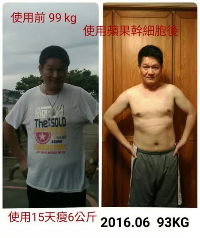 張家口美極客蘋果干細(xì)胞