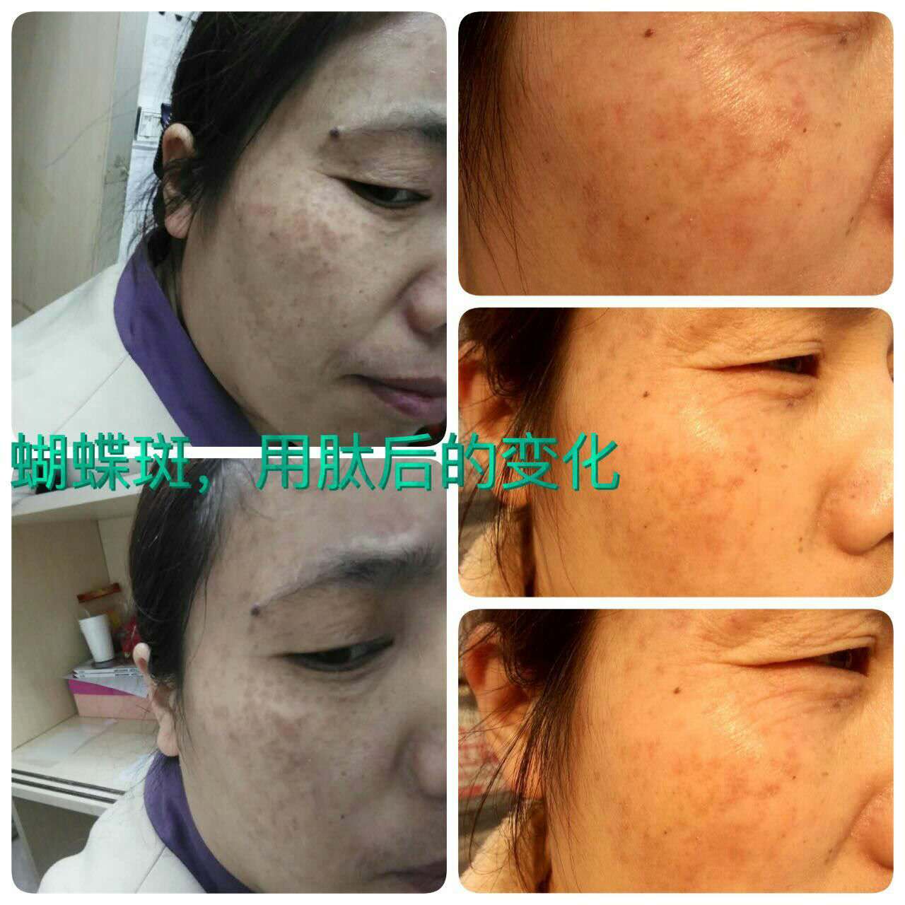 東營美極客小分子肽