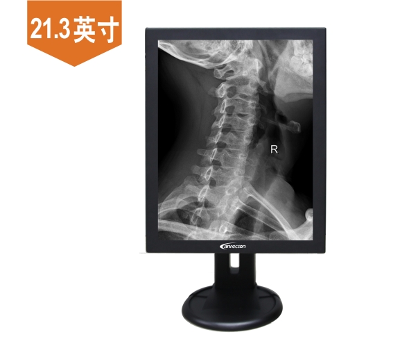 DSA血管造影數字剪影醫用顯示器