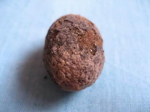 不可讓膽結石成為這些危害