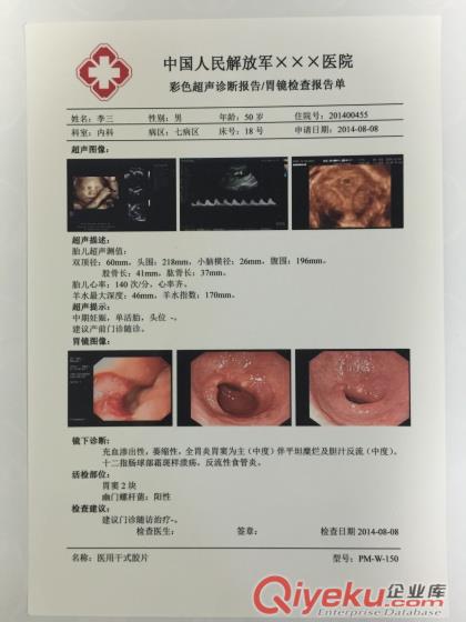 醫用瓷白噴墨超聲科A4打印干式膠片