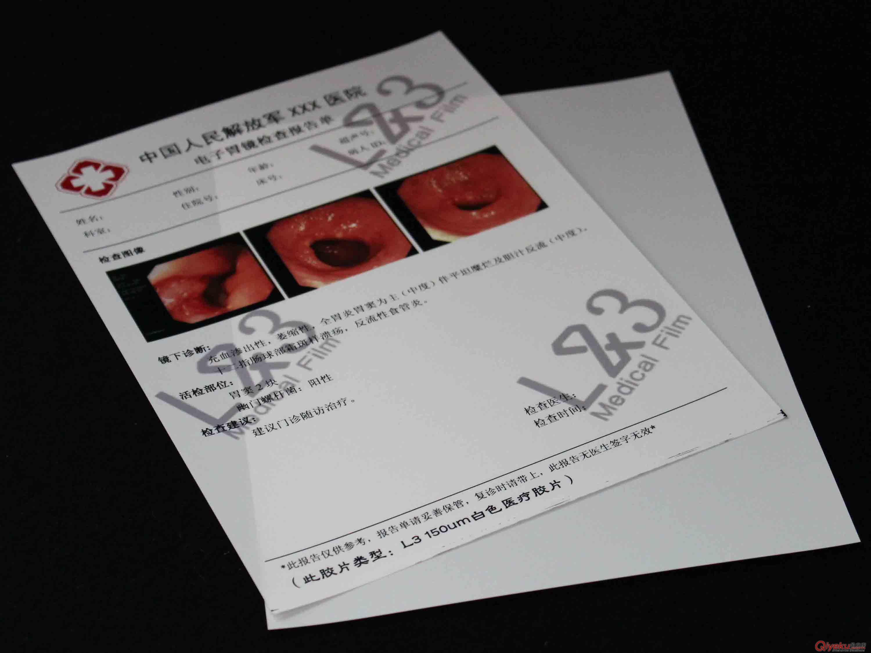 醫用瓷白噴墨超聲科A4打印干式膠片