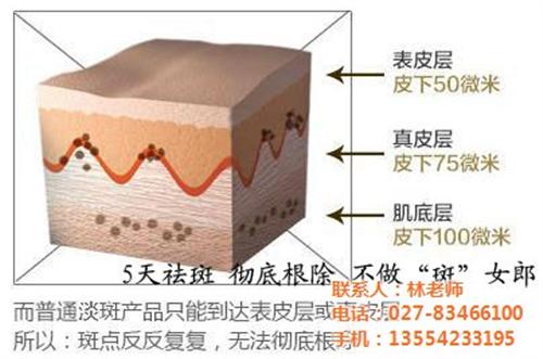 江漢五天祛斑|五天祛斑|五天祛斑效果